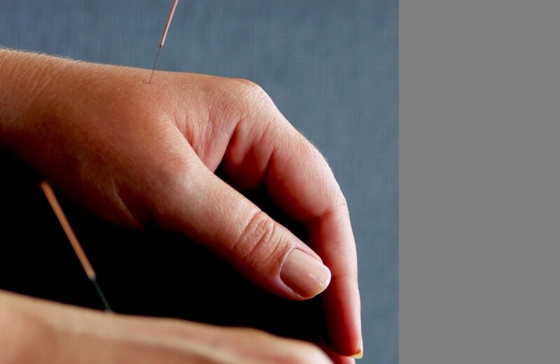 Dry Needling vs. Acupuncture: What’s the Difference and Which Is Better for Pain?