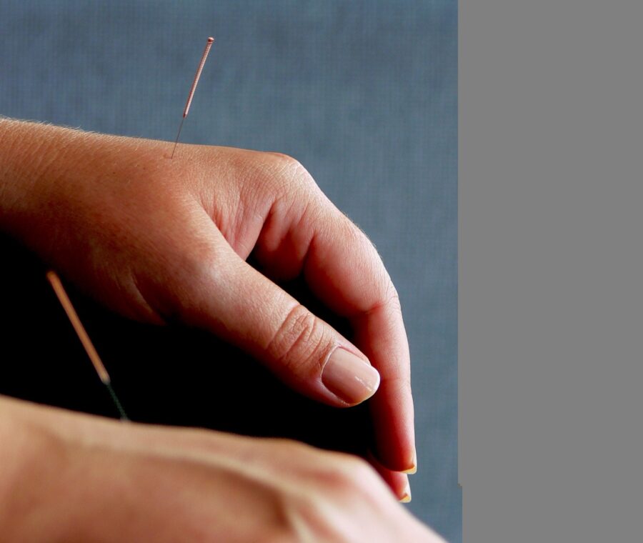 Dry Needling vs. Acupuncture: What’s the Difference and Which Is Better for Pain?